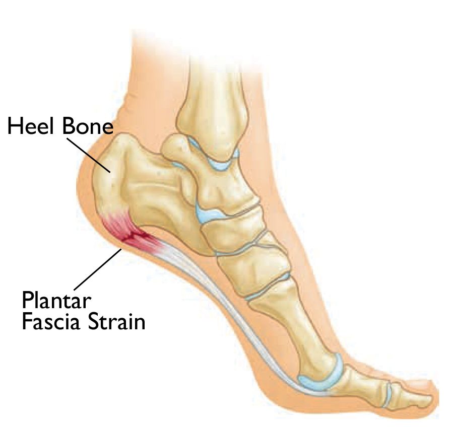 bpc 157 peptide plantar fasciitis Heel Spur Treatment Las Vegas | cobalamin vitamin